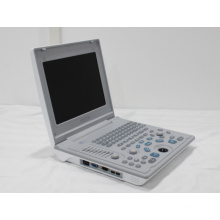 Laptop ultrasound machine with good quality